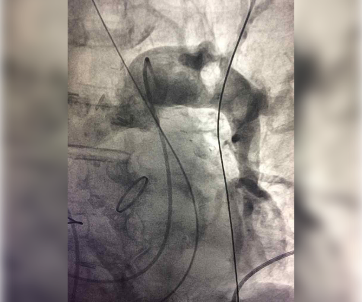 the-most-interesting-medical-cases-in-cardiology-figure-1