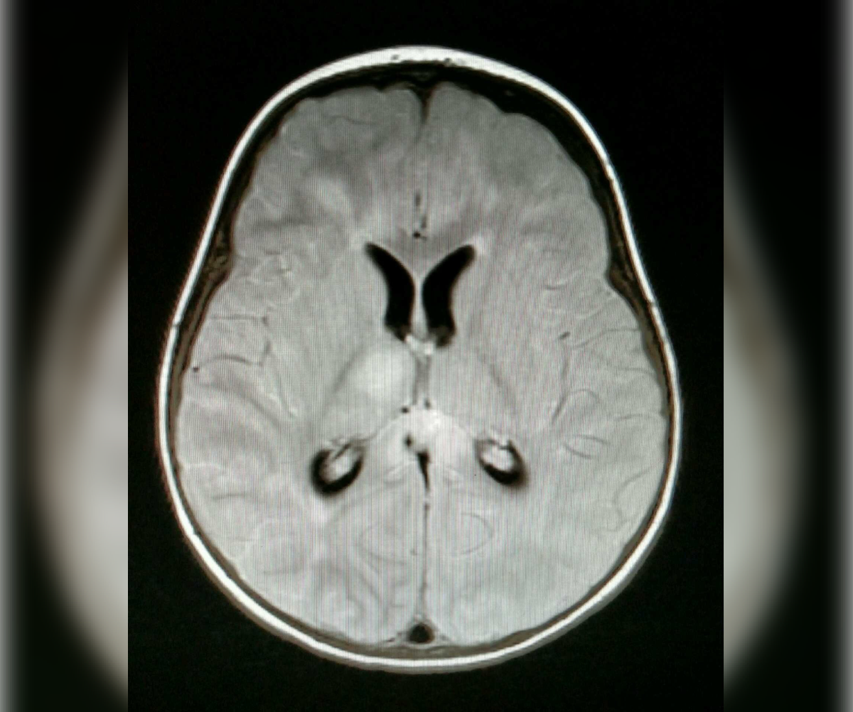 the-most-interesting-medical-cases-in-neurology-figure-1