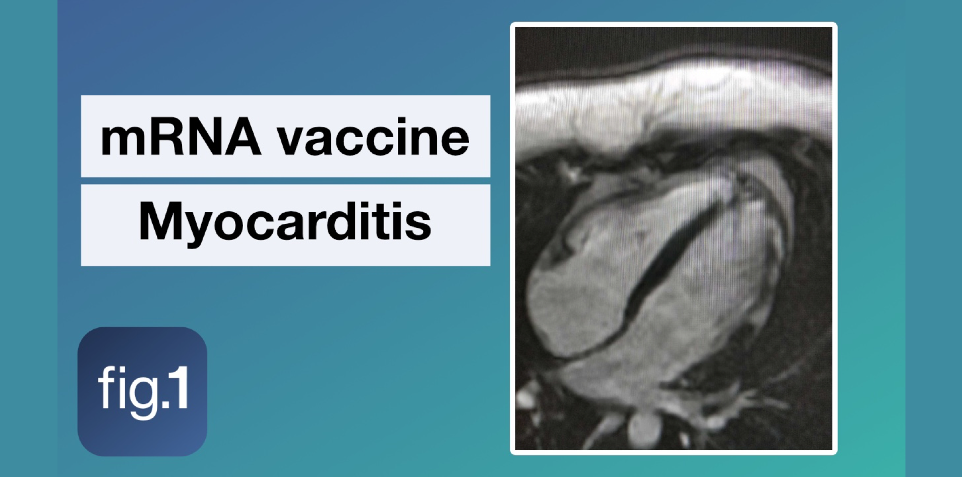 Myocarditis And COVID-19 MRNA Vaccines | Figure 1